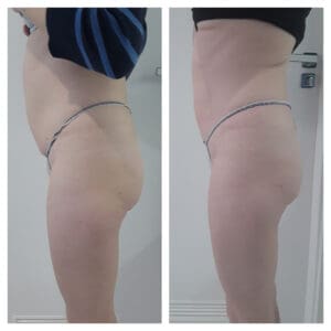 modelowanie sylwetki Kraków