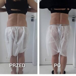 modelowanie sylwetki zdjęcia przed i po