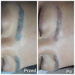 Usuwanie makijażu permanentnego Kraków