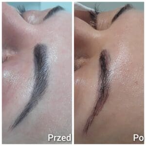 Usuwanie makijażu permanentnego brwi