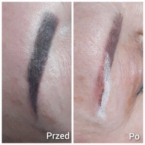 Usuwanie makijażu permanentnego efekty